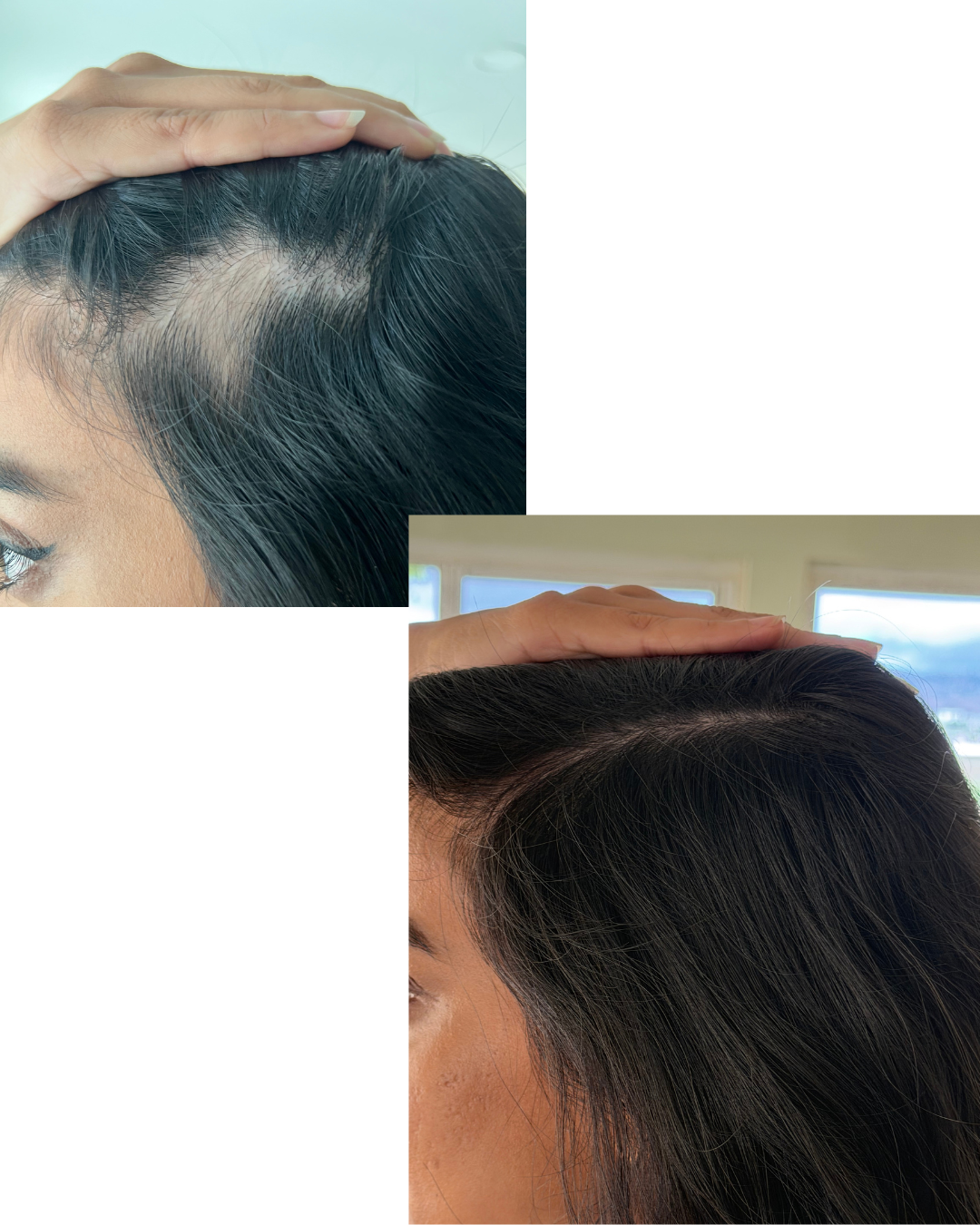 Rosemary &Redensyl™ Activating Scalp Spray